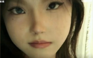 女孩右眼天生蓝色曾一度自卑 医生检查完全正常：网友羡慕