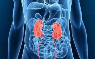 男子做手术查出长有3个肾！医生：多喝水 不要喝浓茶