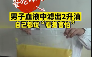 274斤男子血管抽出2升“油”！血管怎么变成了“油管”？