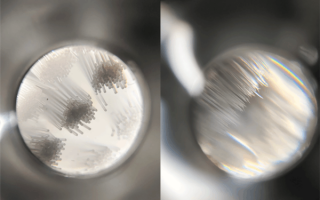 电动牙刷买了两个月后：牙龈萎缩了