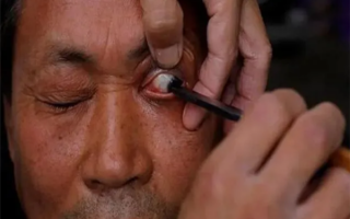 曾经肆虐农村的沙眼怎么突然消失了？全世界都要感谢中国人