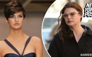 超模鼻祖公开“永久毁容”照片 整形失败翻车：网友唏嘘