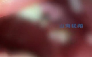 00后男生长期把可乐当水喝：牙全坏