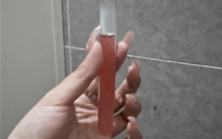 女子喜欢麻辣烫 熬夜连吃一个月：患上急性肾炎 开始尿血