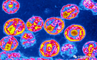 全球首例感染艾滋病痊愈女患者诞生：治疗方法相当神奇