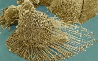 一位黑人女性的癌细胞养了70年：分裂出5000万吨