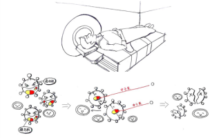 最快30分钟癌细胞清零 费用少20万！这种抗癌技术多神奇？