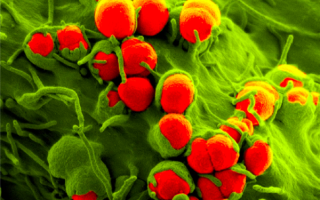 性行为后吃抗生素防感染 靠谱吗？