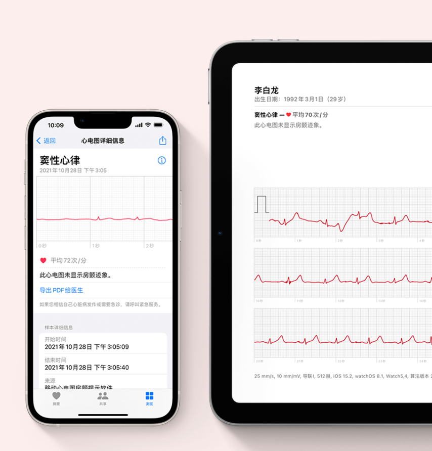 苹果发布 watchOS 8.3，国行版期待已久 Apple Watch 正式上线心电图 ECG 功能 -第3张图片-小猪号